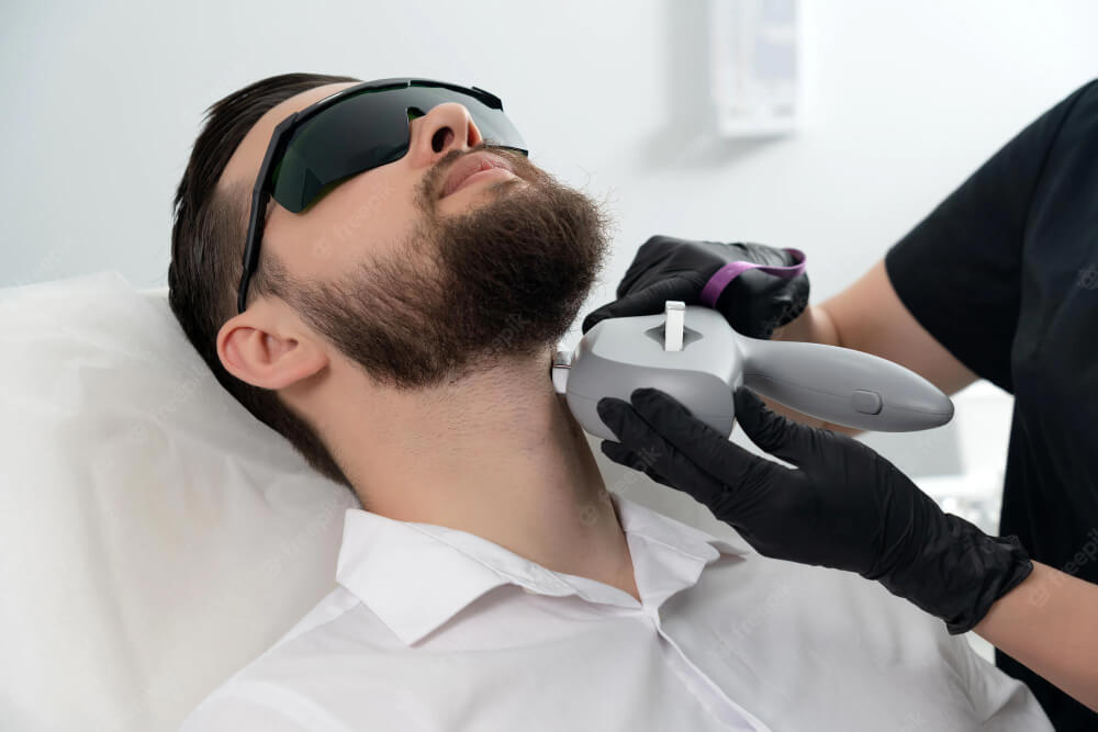Laser beard shaping for defined neck and cheek lines
