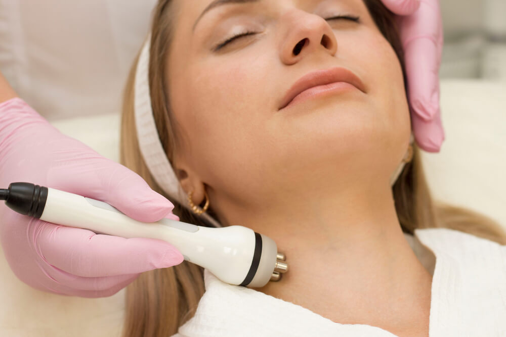 Fractional radiofrequency microneedling treatment