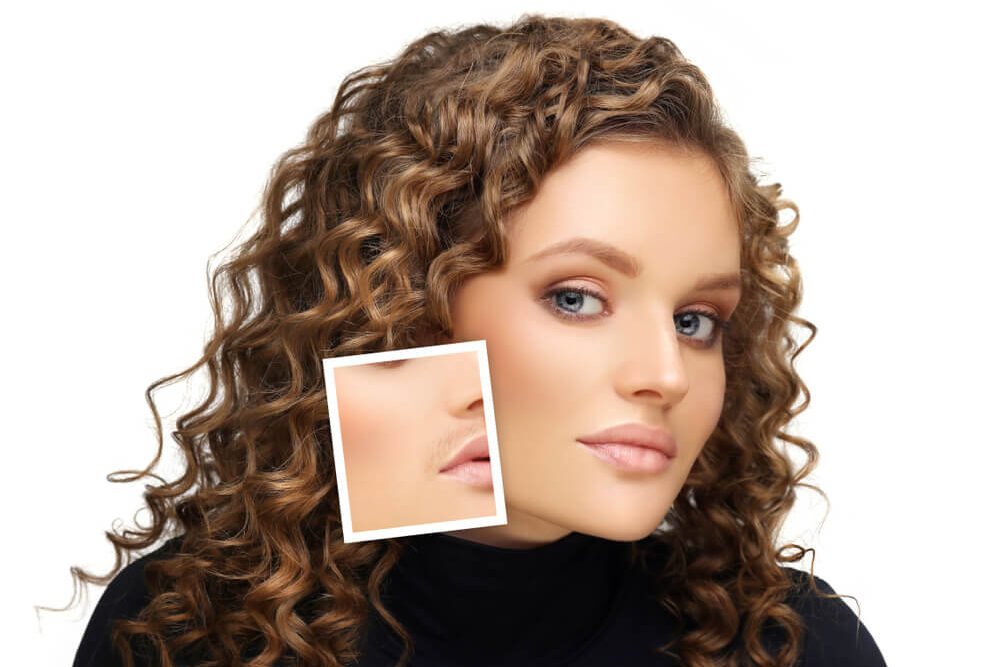 Soft Light laser toning treatment for radiant skin